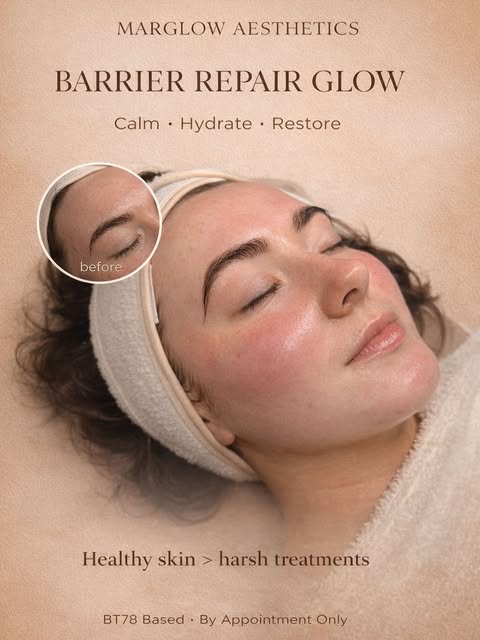 Marglow Barrier Repair Glow treatment post