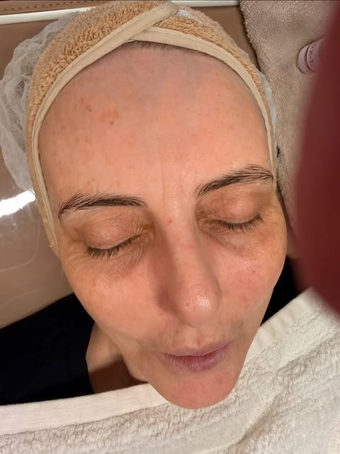 A Marglow client after a clinic treatment